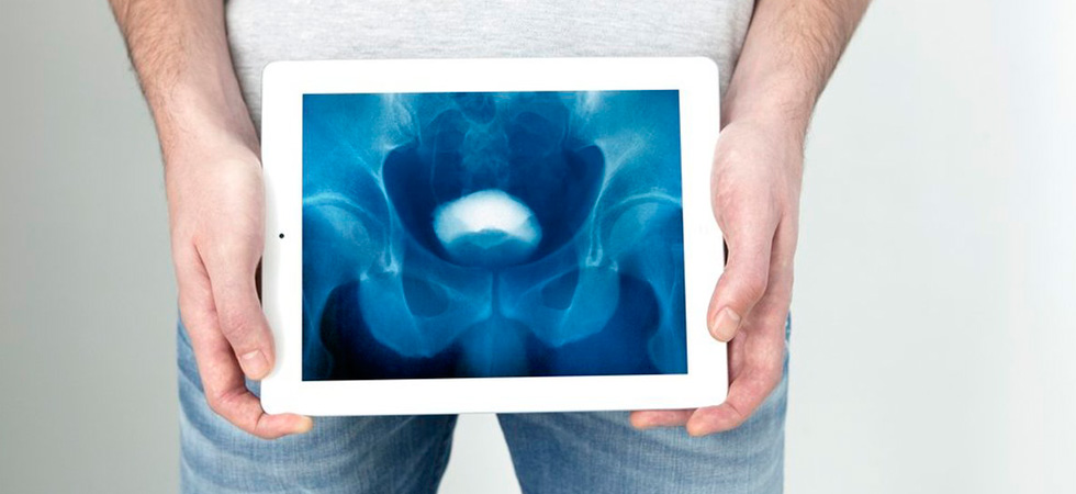 Что такое цистография и как она проводится - фото